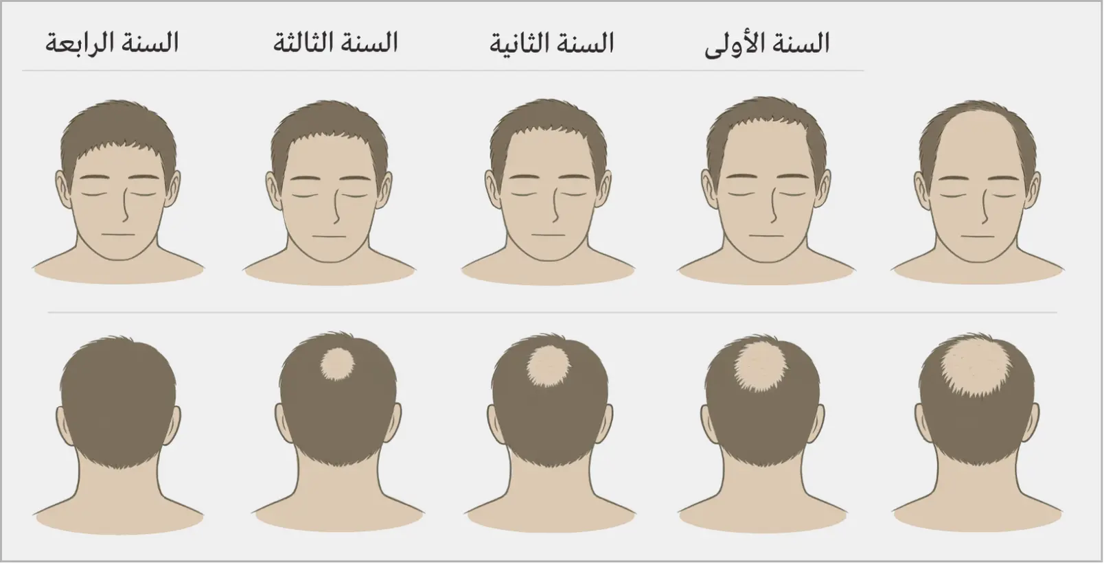 Hairline AR2