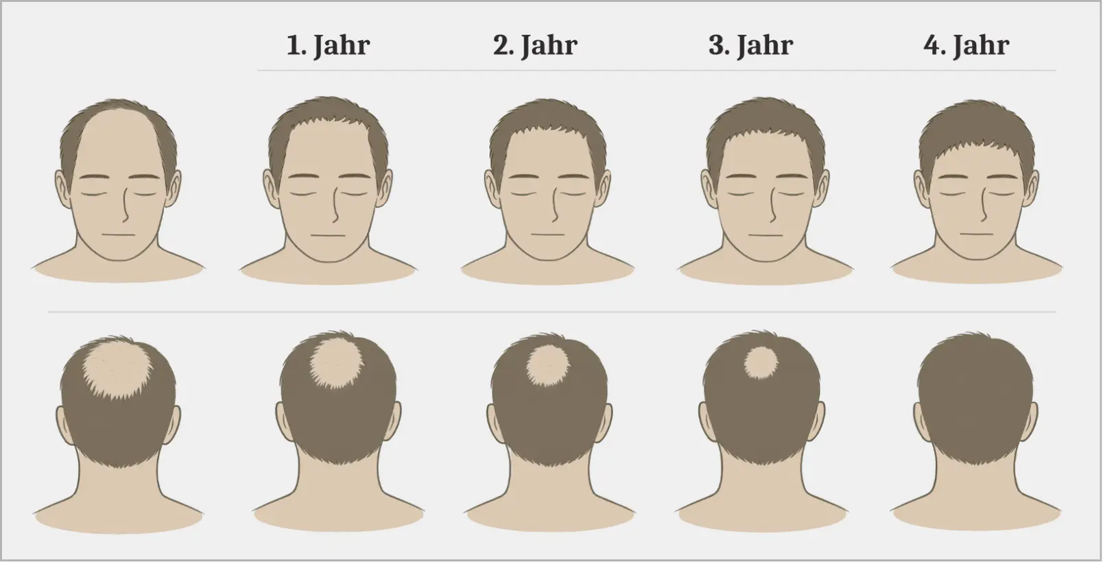 Hairline DE2