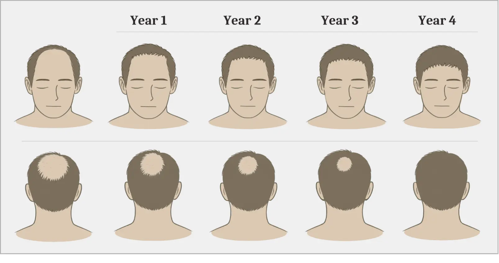 Hairline EN2